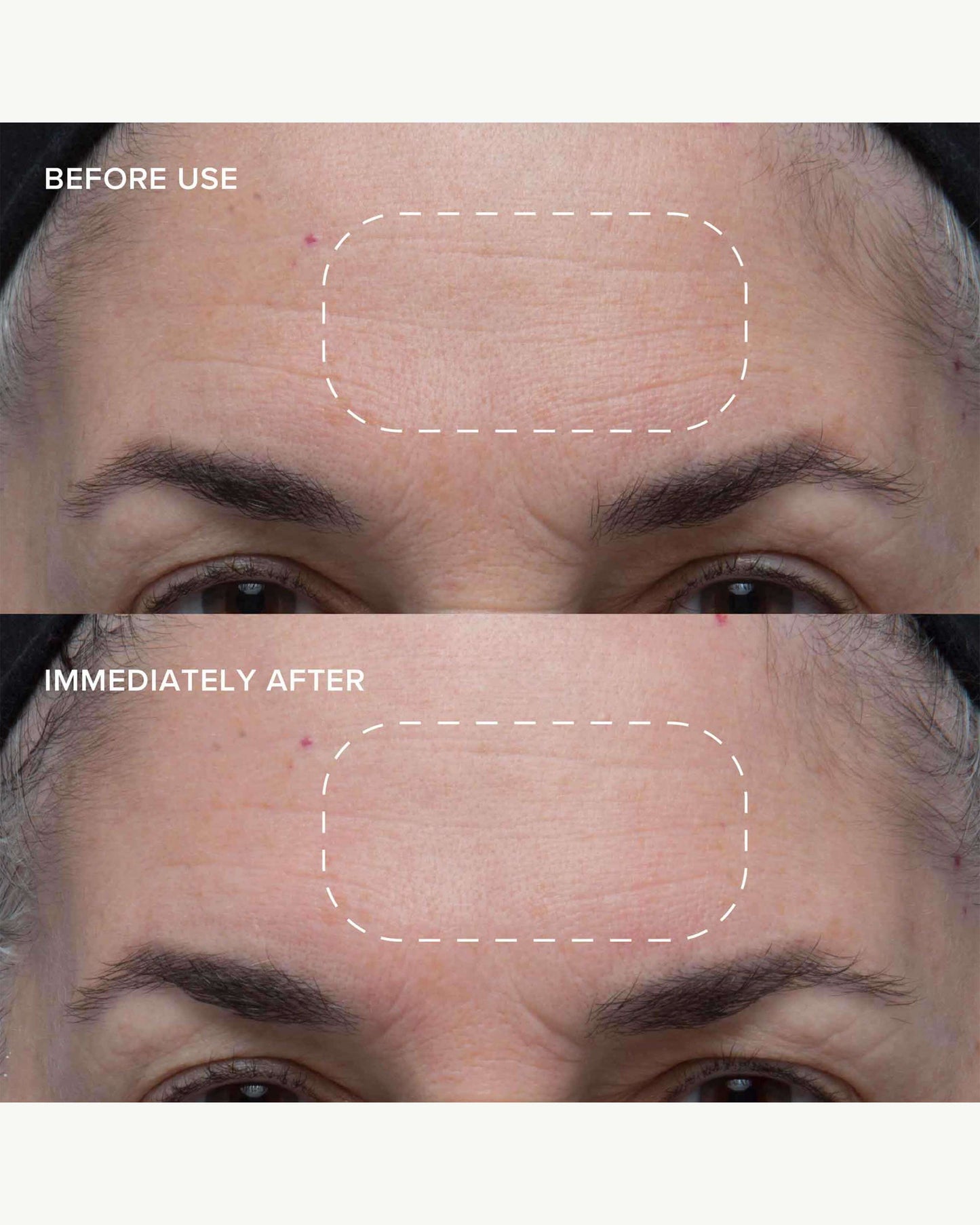 Wild Huckleberry 8-Acid Polishing Peel